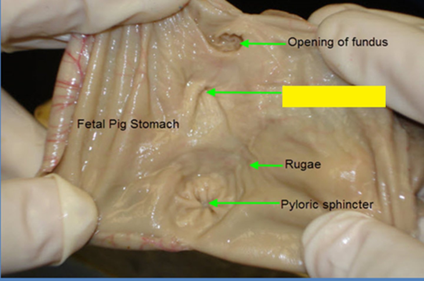<p>opening from the esophagus to the stomach</p>