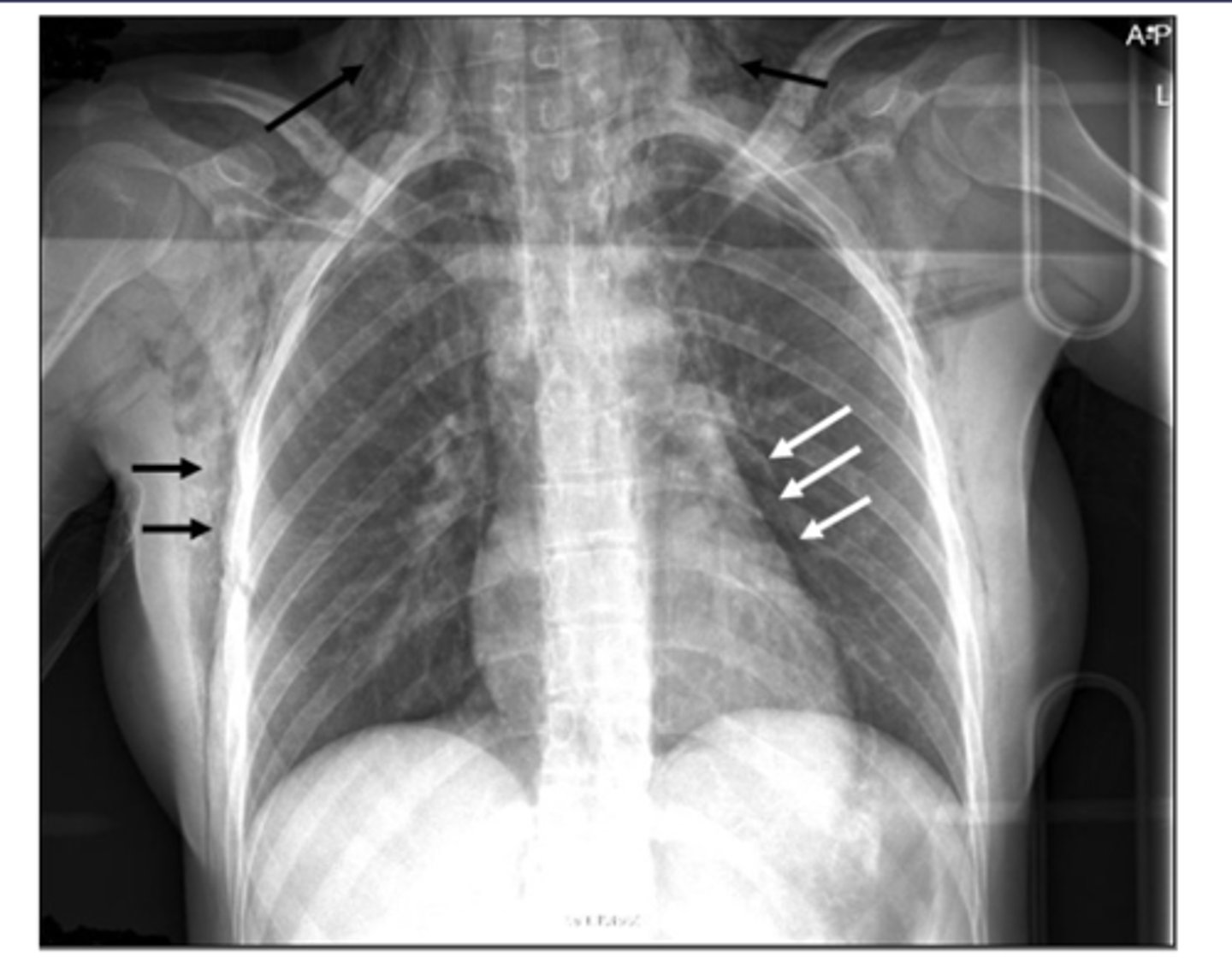 <p>ID black and white arrows</p>