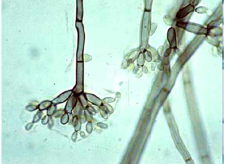 <p>Given the image below, what is the presumptive identification of this organism?</p>
