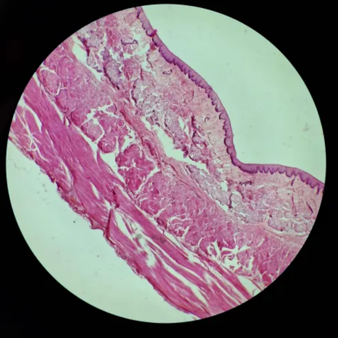 term image