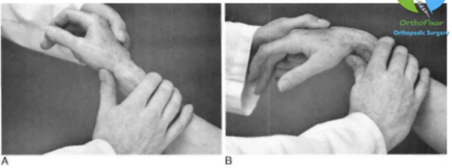 <p>- scaphoid-lunate instability</p><p>procedure:</p><p>- Patient in sitting with elbow resting on treatment table Pt then fixates the patient's radius with one hand and give pressure into dorsal direction on the palmar prominence of the scaphoid with his thumb With the other hand, examiner grasps patient's metacarpals from the ulnar side to control the wrist Examiner bring the wrist from maximal ulnar deviation and slight extension into maximal radial deviation and slight flexion and releases the pressure of the thumb on scaphoid</p><p>(+): Scaphoid shifts back ventrally upon the release of the thumb and produces a painful "thunk" sound. Or reproduces the patient familiar wrist pain on the dorsal side</p>