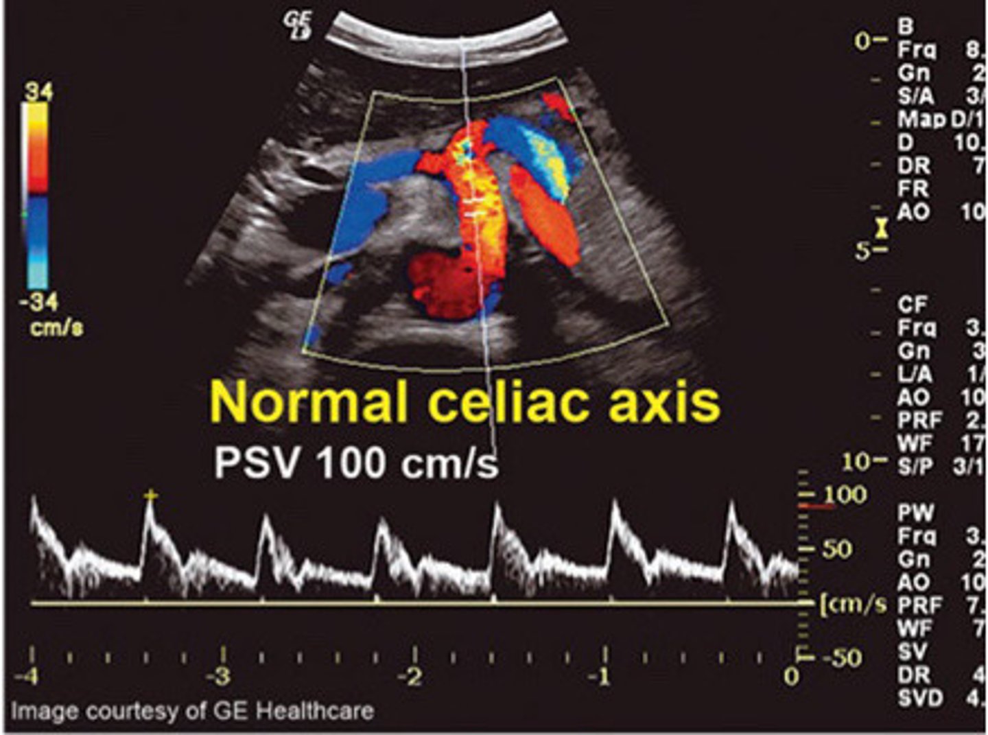 <p>What does this image show</p>