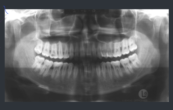 <p>What type of radiograph is this?</p>