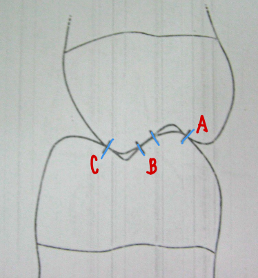 <p>Tooth Contact C</p>