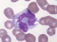 <p>monocyte</p>