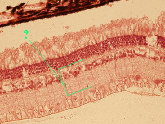 <p><span><span>Identify the indicated layer of the retina.</span></span></p>
