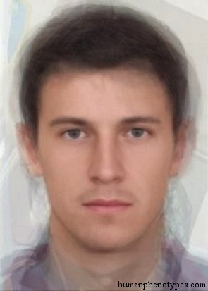 <p>Identify this Phenotype</p>