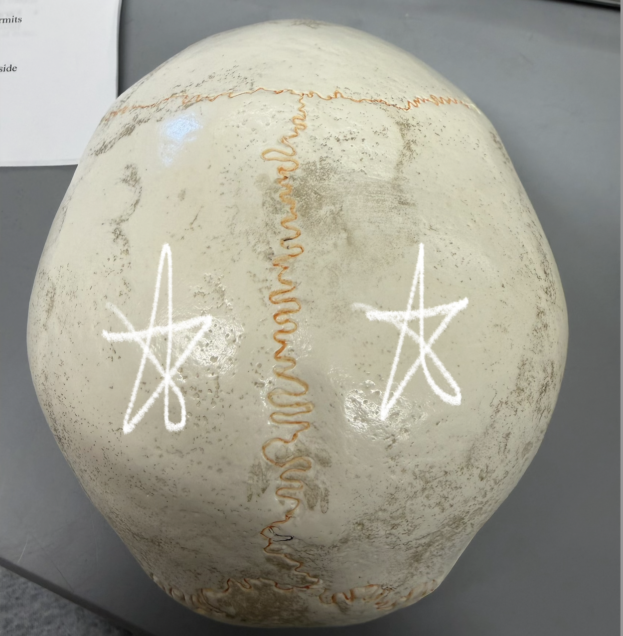 <p>(wall)- curved, rectangular bones behind frontal bone; form most of superior and lateral portion of skull; join at midline @ sagittal suture</p>