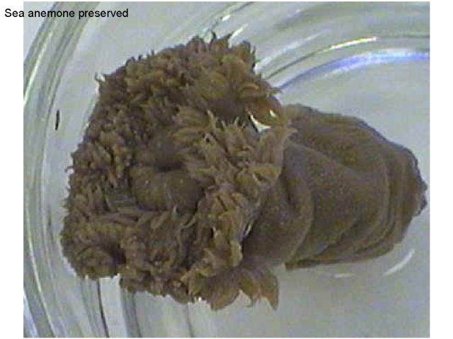 <p>Phylum?Class?<br>Symmetry? Tissue type? </p>