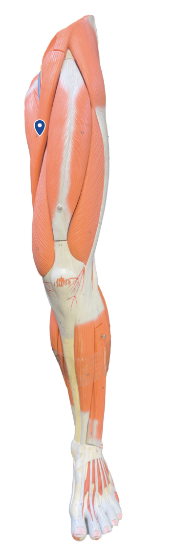 <p>What muscle is the arrow pointing to?</p>