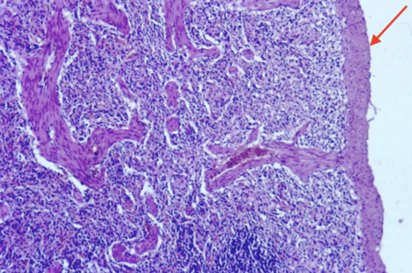 <p>what is this external CT called? what component of the parenchymal organ is it?</p>