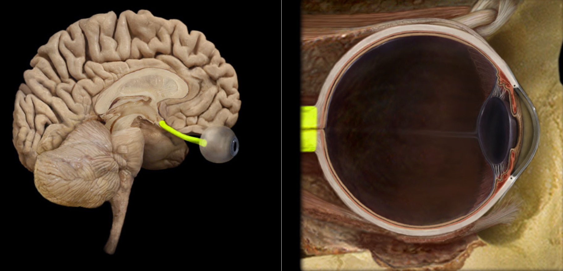 <h4 collapsed="false" seolevelmigrated="true"><strong>Location:</strong></h4><ul><li><p>Orbit</p></li><li><p>Middle cranial fossa</p></li></ul><h4 collapsed="false" seolevelmigrated="true"><strong>Composition:</strong></h4><ul><li><p>Special sensation</p></li></ul><h4 collapsed="false" seolevelmigrated="true"><strong>Special sensation:</strong></h4><ul><li><p>Vision</p></li></ul><h4 collapsed="false" seolevelmigrated="true"><strong>CNS connection:</strong></h4><ul><li><p>Lateral geniculate nucleus of thalamus</p></li></ul><h4 collapsed="false" seolevelmigrated="true"><strong>Cranial foramina:</strong></h4><ul><li><p>Optic canal</p></li></ul><h4 collapsed="false" seolevelmigrated="true"><strong>Comment:</strong></h4><ul><li><p>Special sensation includes smell, vision, taste, hearing, and balance</p></li><li><p>Optic nerve formed by axons of retinal ganglion cells</p></li><li><p>Retinal ganglion cell axon pathway: optic nerve &gt; optic chiasm &gt; optic tract &gt; brainstem nuclei (including lateral geniculate nucleus of thalamus)</p></li><li><p>Optic nerve also known as CN II</p></li></ul>