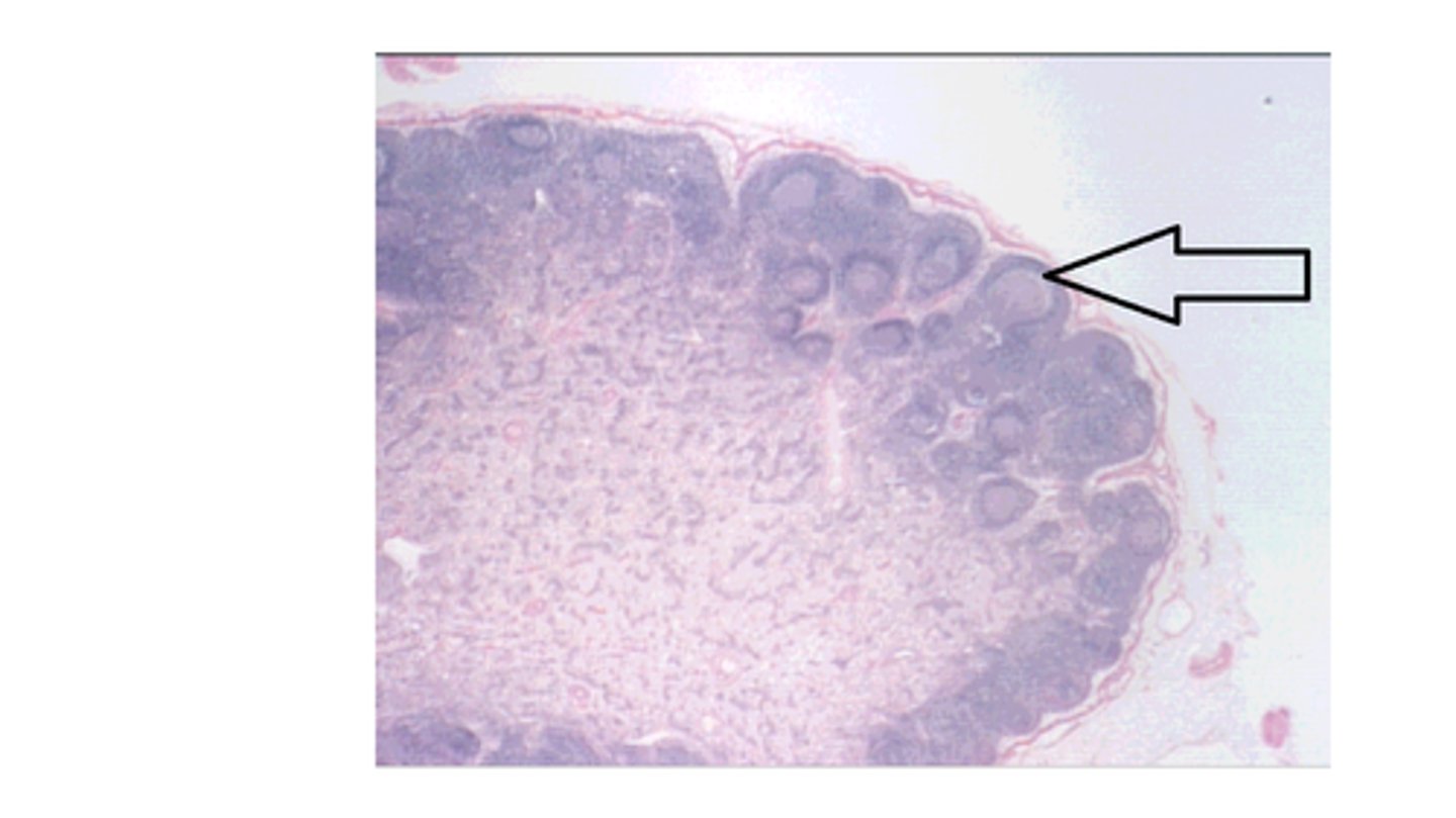 <p>Identify the structure at the arrow?</p>