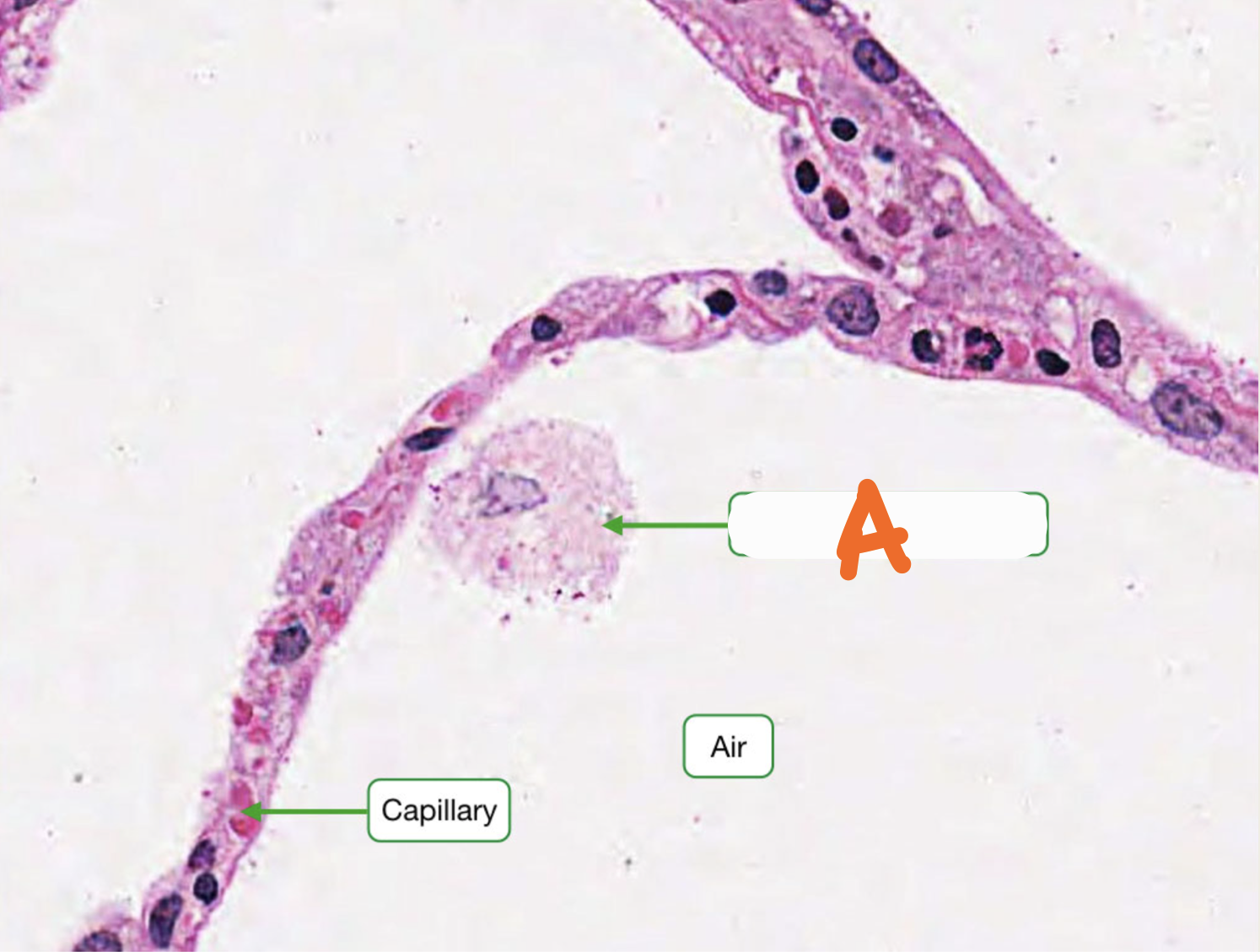 <p>Identify the structure</p>