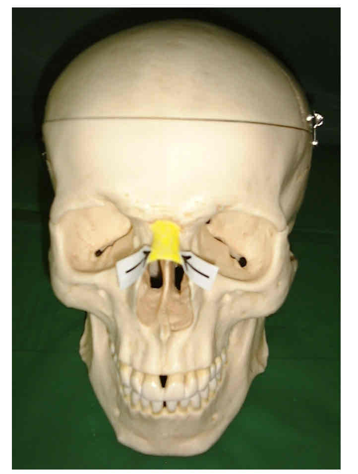 term image
