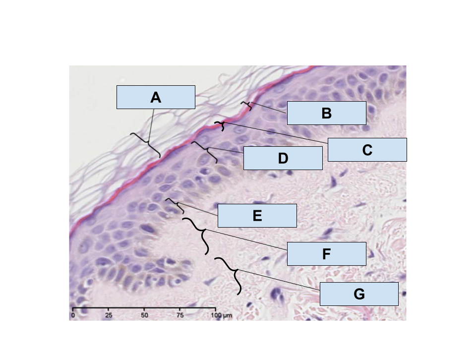 <p>What layer is&nbsp;F indicating?</p>