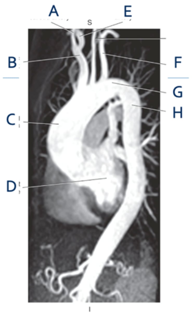 <p>Label A</p>