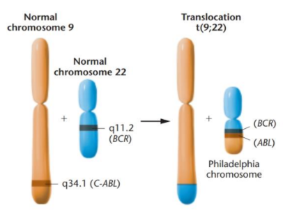 <p>non-lethal overproduction of white blood cells, these have an abnormality - Philadelphia chromosome</p><ul><li><p>translocation between long arms of Chr 9 &amp; Chr 22</p></li><li><p>fusion protein Bcr-Abl has hyperactive kinase activity</p></li></ul><p></p><p>continues for several years between rapidly deteriorating&nbsp;</p><ul><li><p>early stage = cells show translocation</p></li><li><p>late stage = several abnormalities, further mutations</p></li></ul><p></p>