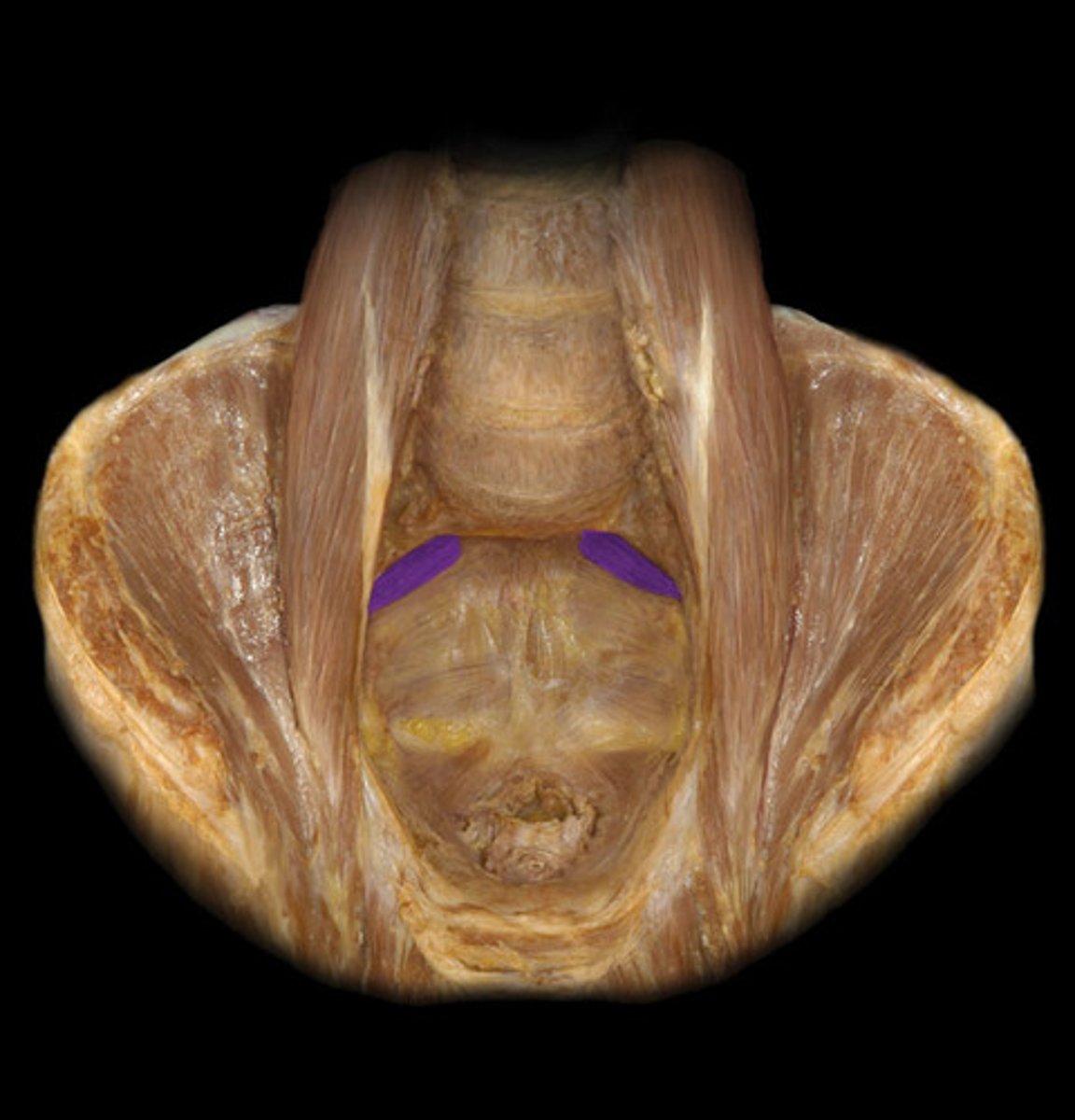 <p>-deep to sacral plexus</p><p>-muscle striations between nerve tissue</p>