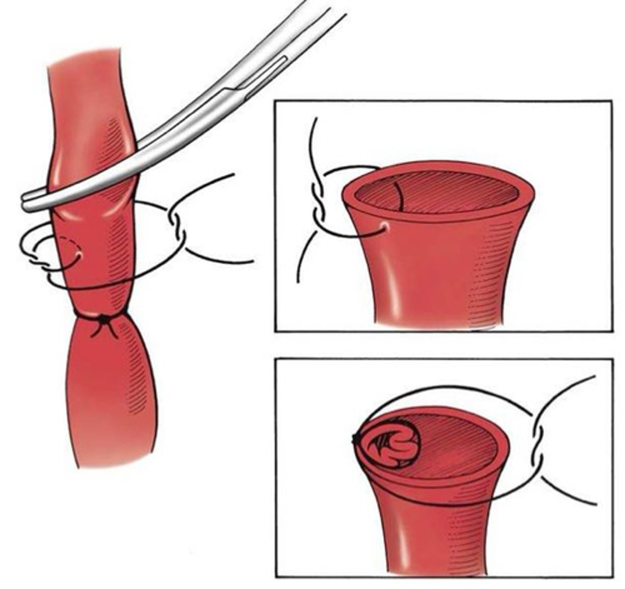 <p>What is demonstrated here?</p>