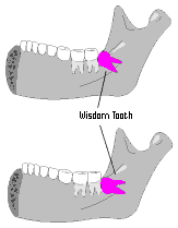 <p>Vestigial Organs/Structures</p>