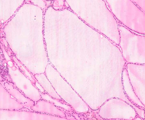 <p>What seems to be microscopically wrong? What organ?</p>