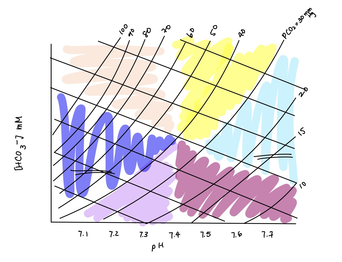 <p>acid base imbalance in dark blue? causes? compensation?</p>