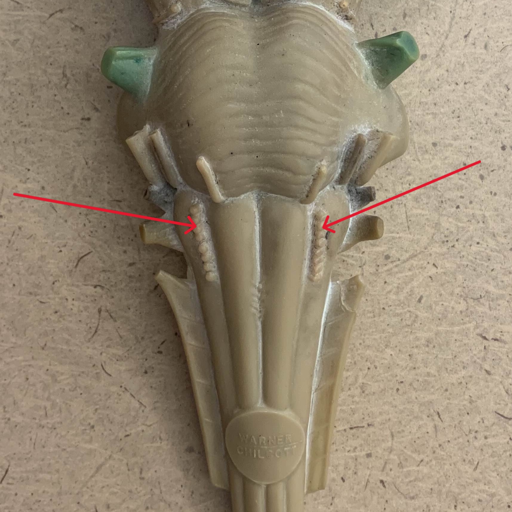 <p>Which nerve of the brain is:</p><ul><li><p>Looks like dots olive</p></li><li><p>Medial to vagus</p></li></ul><p></p>