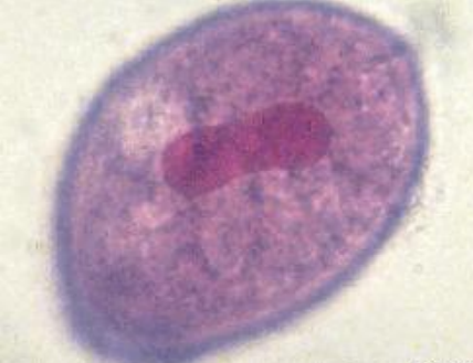 <p>what is this ?</p><p>phylum ? </p><p>organ of locomotion ?</p><p>two special characters ?</p>