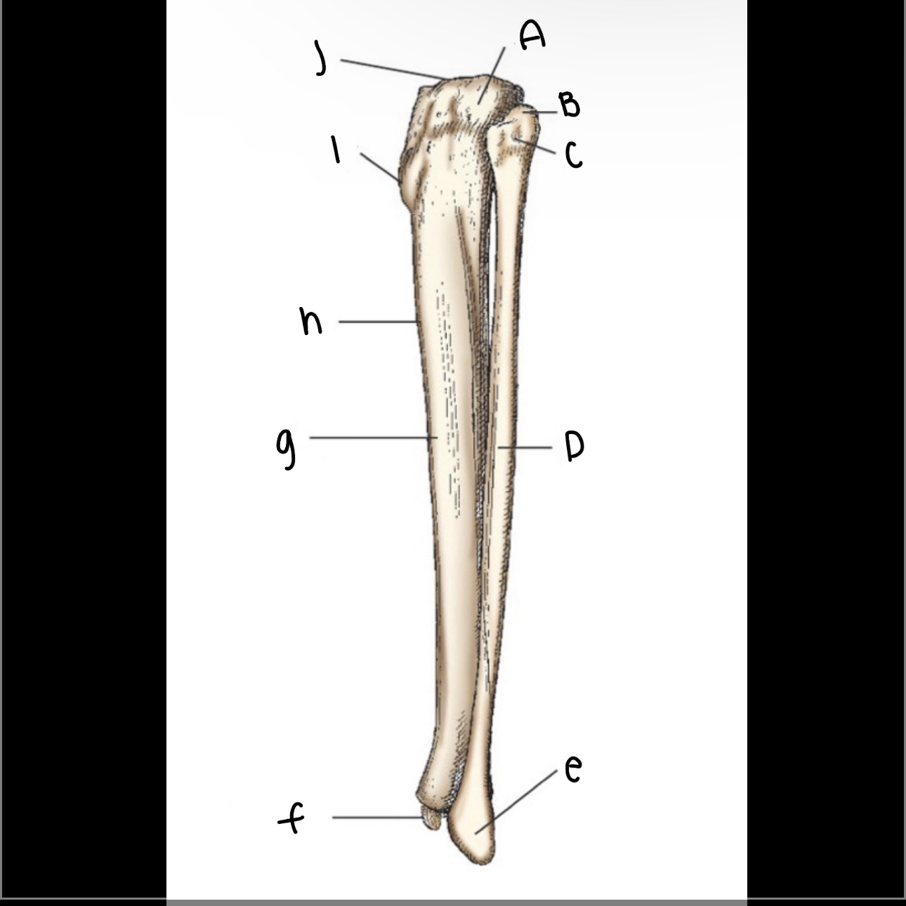 <p>What is letter D pointing to?</p>