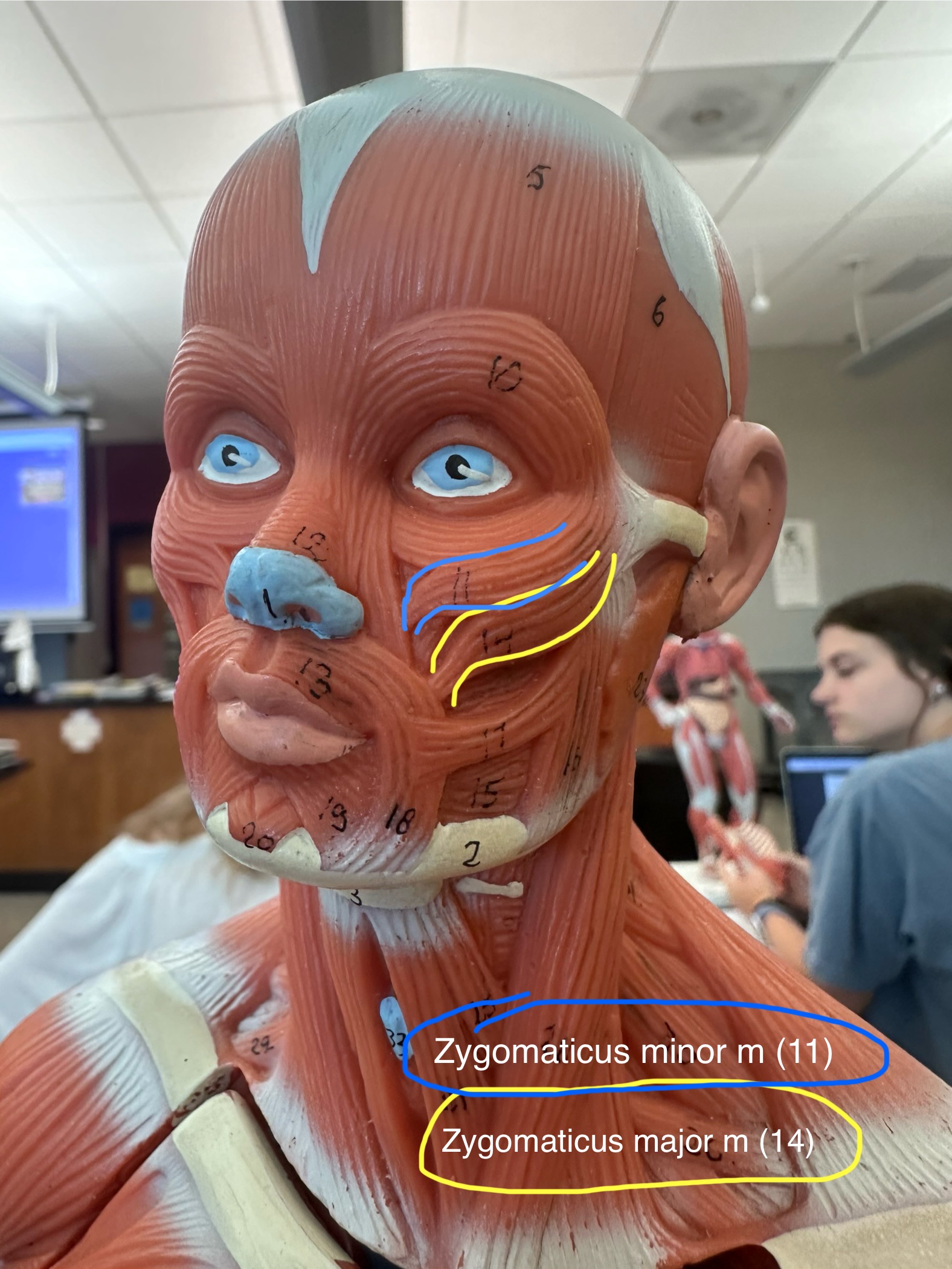 <p>The zygomaticus major muscle is in yellow and the zygomaticus minor muscle is in blue. These muscles raise the lateral corners of the mouth. These muscles allow for smiling.</p><ul><li><p>The origin is the zygomatic bone. </p></li><li><p>The insertion is the skin and muscle at the corner of the mouth.</p></li></ul>