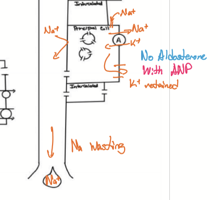 <p>Na wasted and K remains in plasma. Decreases BP, plasma osmolarity, and increases plasma K</p>