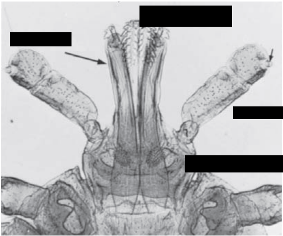 Identify the pointed structure