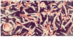 <p>Family-Filoviridae</p><p>Single stranded RNA, - strand, enveloped</p><p>Causes Ebola and Marburg viruses</p><p>Found in animal species</p>