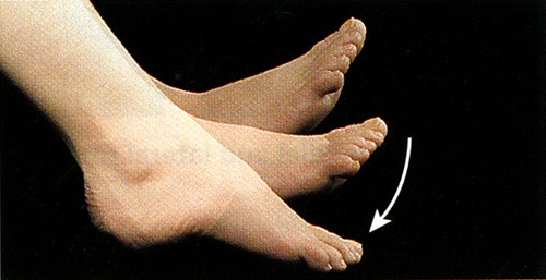 <p>bending of the sole of the foot by curling the toes toward the ground</p>