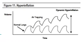 <p>Incomplete expiration prior to the initiation of the next breath causes progressive air trapping (hyperinflation)</p><p>This accumulation of air increases alveolar pressure at the end of expiration, which is referred to as auto-PEEP</p><ul><li><p><span>Usually because we haven't given the patient enough time to expire</span></p><ul><li><p><span>RR too high</span></p></li><li><p><span>Patient spontaneously breathing on their own and overriding the ventilator breaths</span></p></li></ul></li><li><p><span>On a waveform will see baseline pressure continue to go up</span></p></li></ul><p></p>