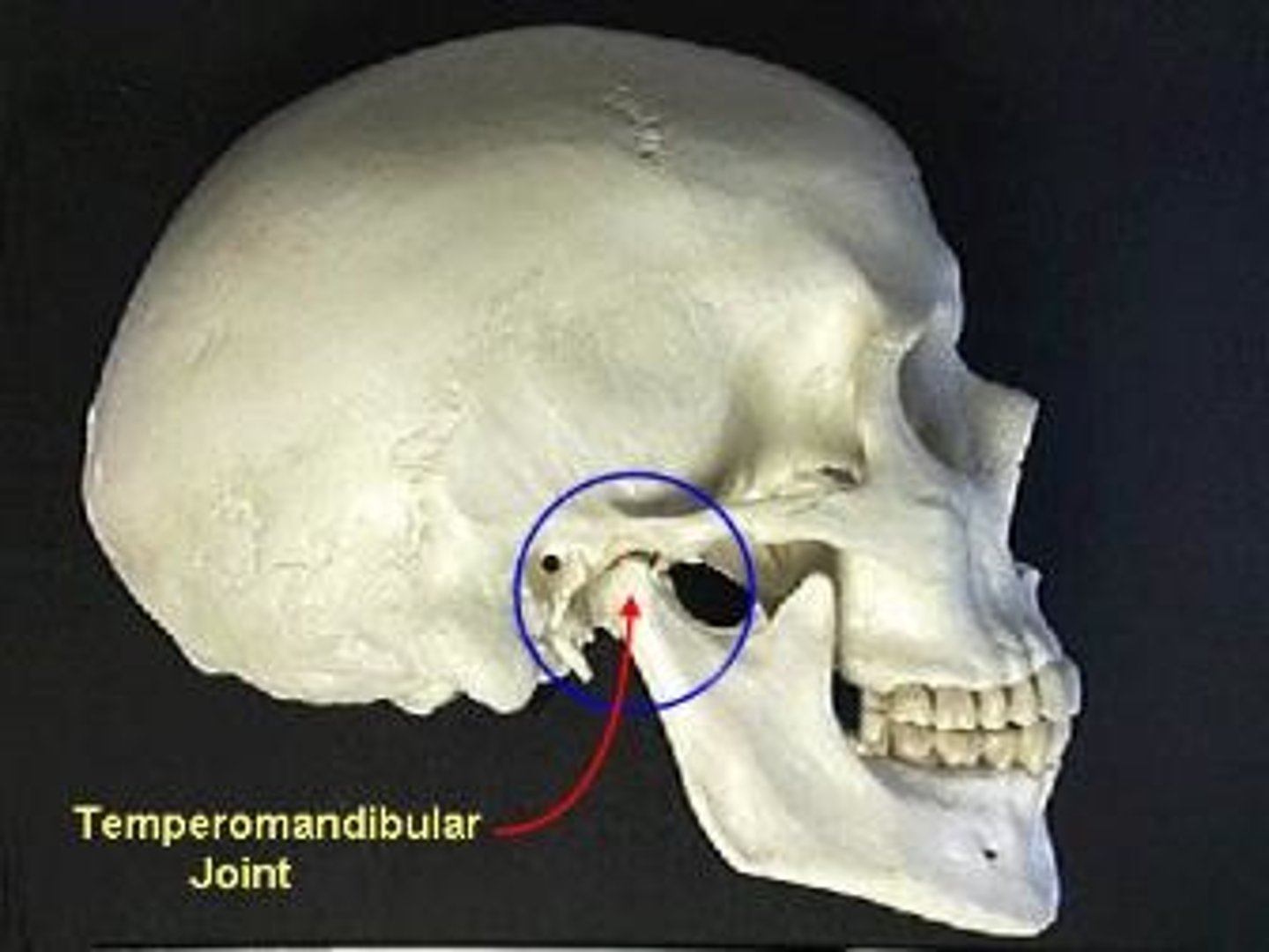 <p>temporomandibular joint</p>