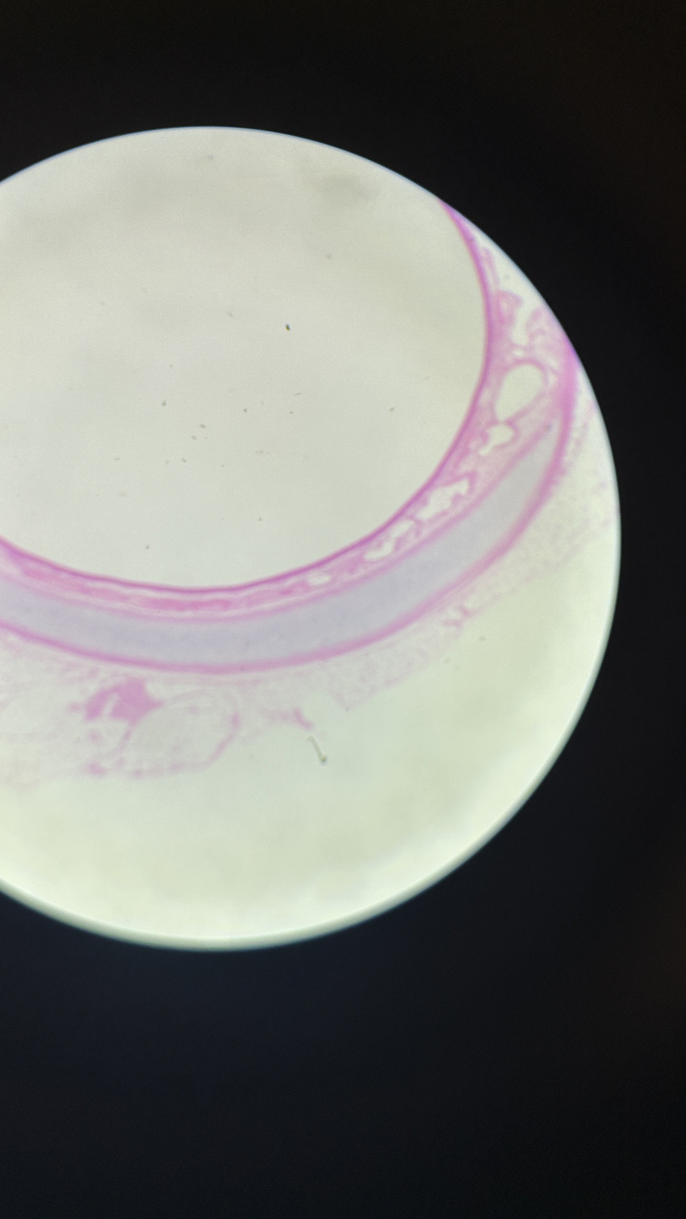 <p>What is the magnification level of the Hydraline Cartilage?</p>