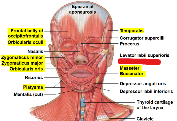 <p>What muscle is this?</p>