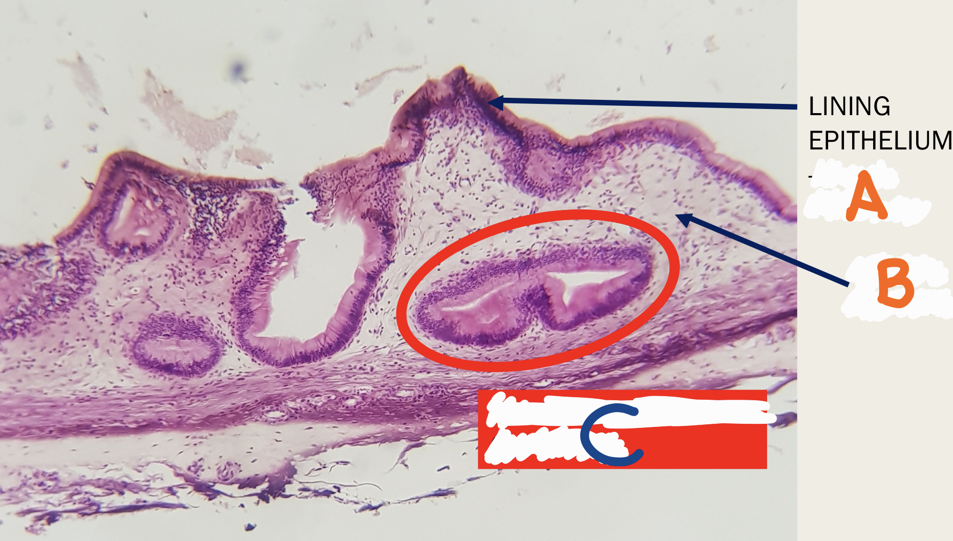 <p>Identify the structure</p>