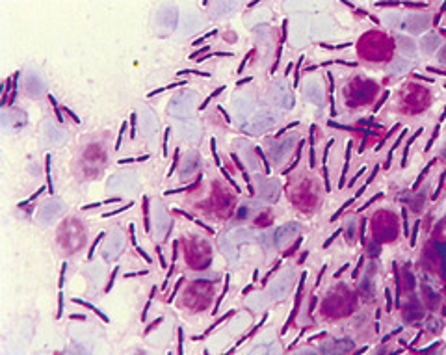 <p>Escherichia coli, Klebsiella pneumoniae, Salmonella enterica, Shigella species</p>
