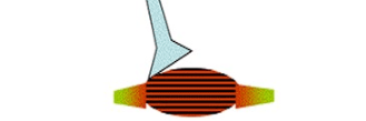 <p>Irritability / Responsiveness</p>
