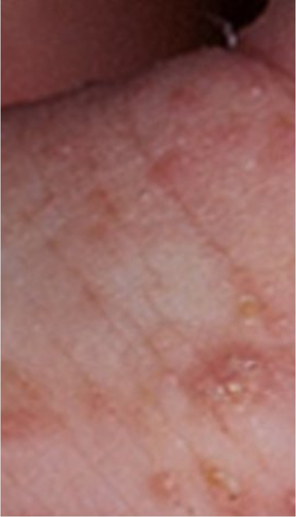 <p>what condition is this?</p>