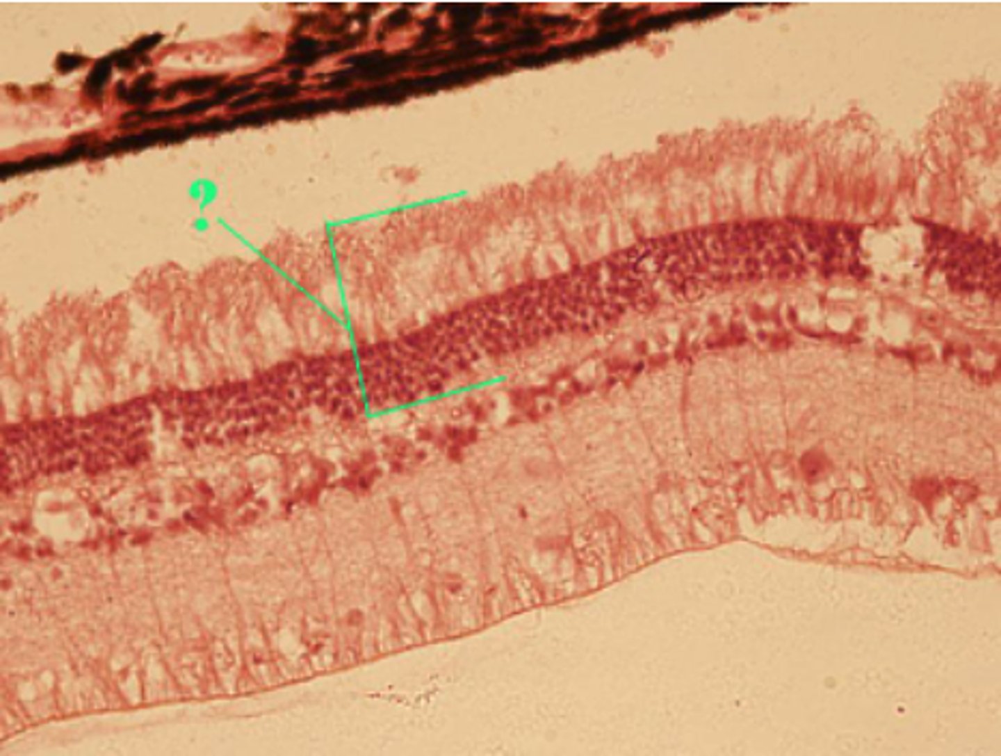 <p>photoreceptor cell layer</p>