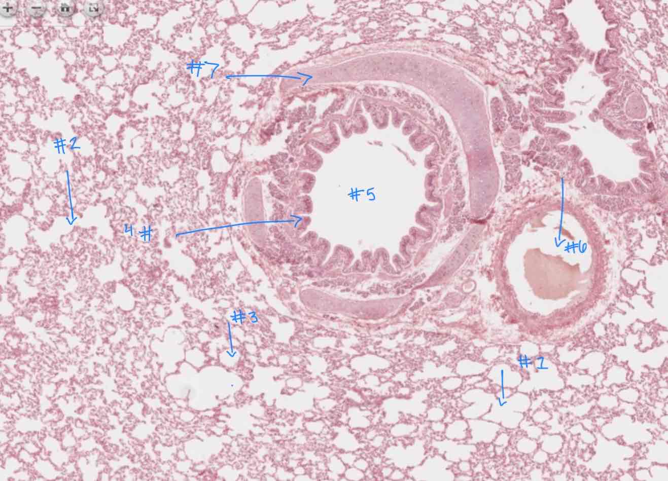 <p>What structure is listed as #1</p>