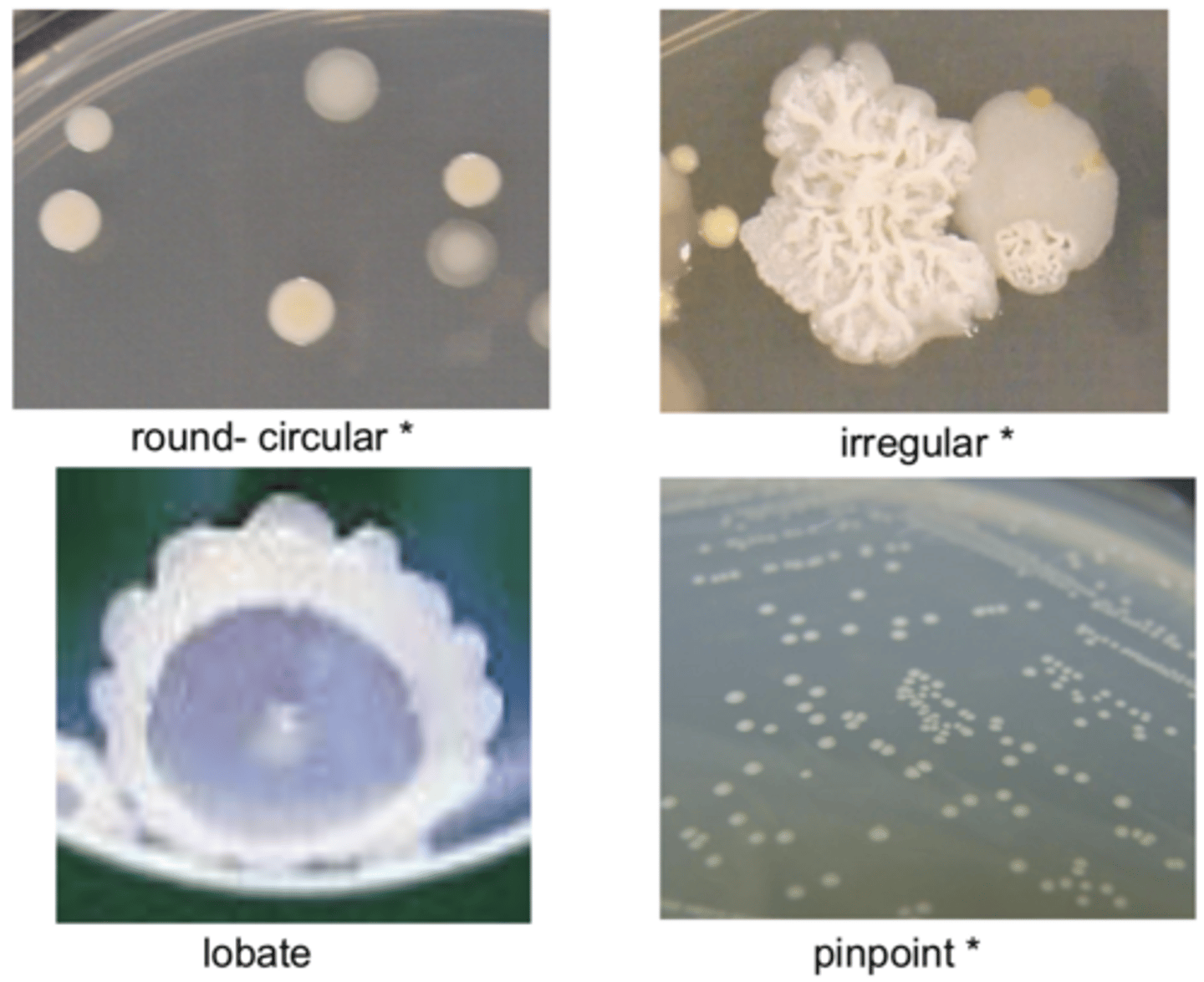 <p>circular, irregular, lobate, pinpoint</p>