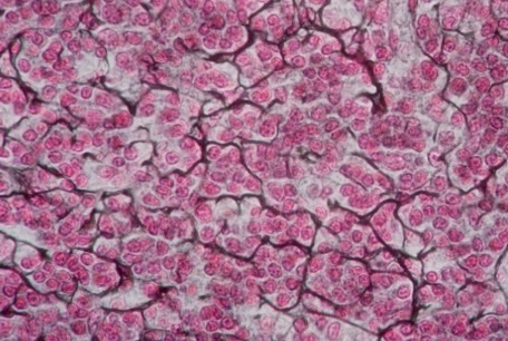 <p><strong>-dark staining fibers </strong>with <strong>scattered pale cells</strong></p><p><strong>-function → </strong><span>provide a</span><strong><span> flexible internal framework for soft organs & supporting cells for fluid</span></strong></p>