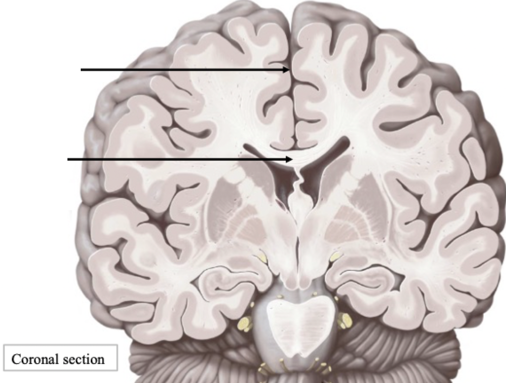 <p>Cerebrum Features </p>