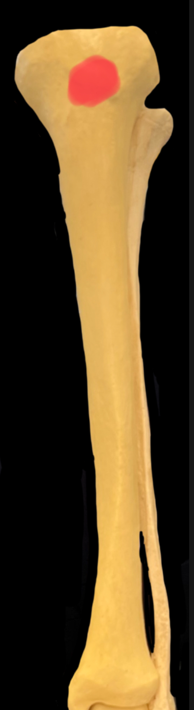 What is highlighted in red?

What attaches here?