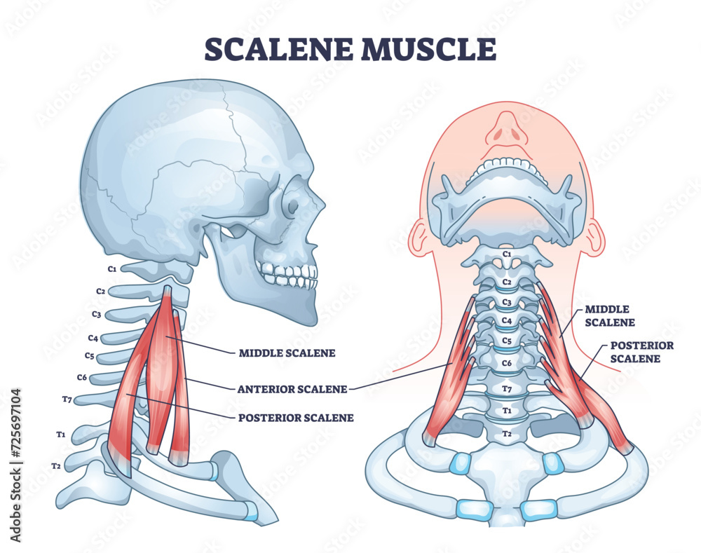 <p>T/F The scalenus anterior muscle</p><p><strong>F -</strong> A. is anterior to the subclavian vein</p><ul><li><p><strong>scalenus anterior</strong> is actually <strong><u>posterior</u></strong><u> </u>to the subclavian vein</p></li></ul><p><strong>F -</strong> B. is anterior to the phrenic nerve</p><ul><li><p><strong>phrenic nerve</strong> lies <strong>on the anterior surface</strong> of the scalenus anterior muscle</p></li></ul><p><strong>F -</strong> C. is anterior to the suprascapular artery</p><ul><li><p><strong>suprascapular artery</strong> usually passes <strong>anterior</strong> to the scalenus anterior</p></li></ul><p><strong>T -</strong> D. is used in deep respiration</p><p><strong>F -</strong> E. is attached to the first and second ribs.</p><ul><li><p>attached <strong>only to the first rib</strong></p></li><li><p>scalenus posterior attaches to both the <strong>first and second ribs</strong></p></li></ul><p></p>